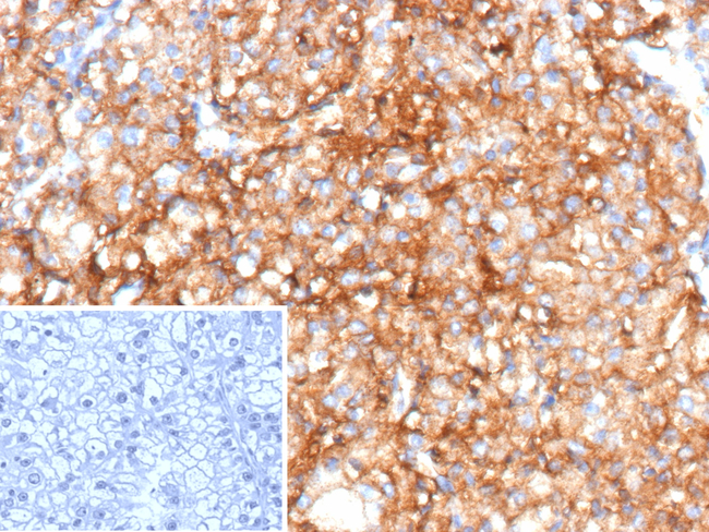 CD70/TNFSF7 (Activated T- & B-Lymphocyte Marker) Antibody in Immunohistochemistry (Paraffin) (IHC (P))