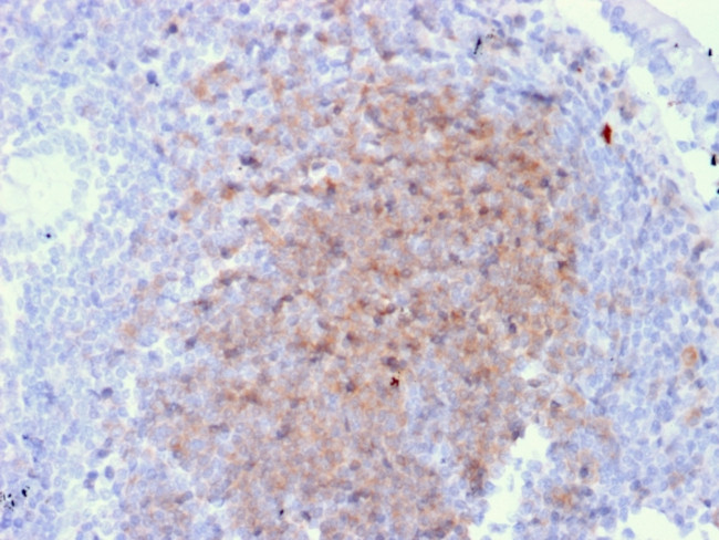 CD72 (B Cell Marker) Antibody in Immunohistochemistry (Paraffin) (IHC (P))