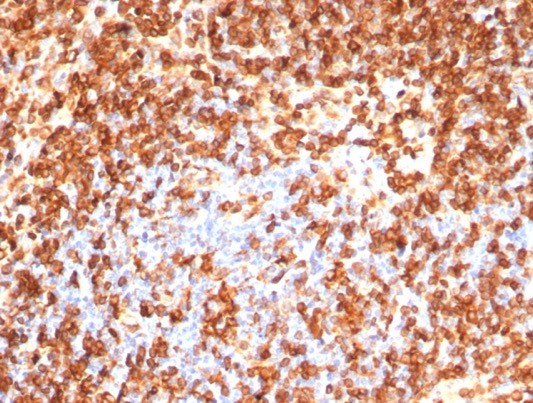 CD74 (B-Cell Marker) (Transcription Regulator) Antibody in Immunohistochemistry (Paraffin) (IHC (P))
