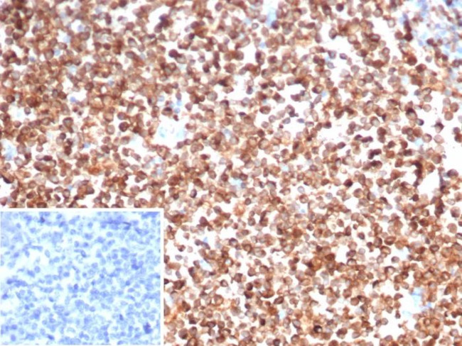 CD74 (B-Cell Marker) (Transcription Regulator) Antibody in Immunohistochemistry (Paraffin) (IHC (P))