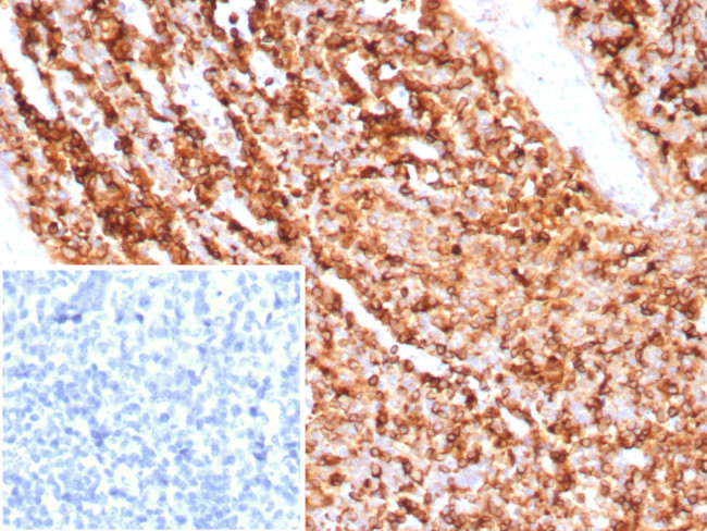 CD74 (B-Cell Marker) (Transcription Regulator) Antibody in Immunohistochemistry (Paraffin) (IHC (P))