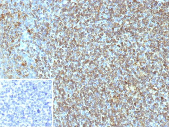 CD74 (B-Cell Marker) (Transcription Regulator) Antibody in Immunohistochemistry (Paraffin) (IHC (P))