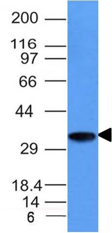 CD74 (B-Cell Marker) Antibody in Western Blot (WB)