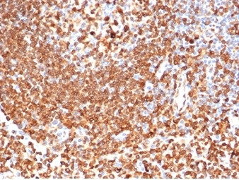 CD74 (B-Cell Marker) (Transcription Regulator) Antibody in Immunohistochemistry (Paraffin) (IHC (P))