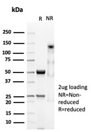 CD74 (B-Cell Marker) Antibody in SDS-PAGE (SDS-PAGE)