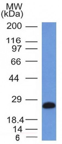 CD79a (B-Cell Marker) Antibody in Western Blot (WB)