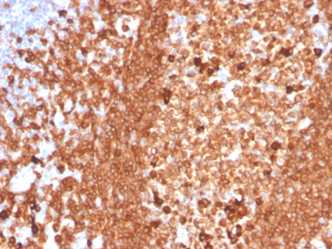 CD79a Antibody in Immunohistochemistry (Paraffin) (IHC (P))