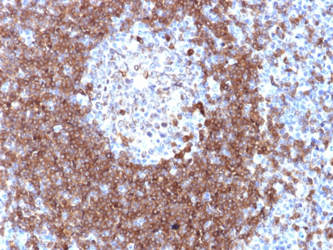 CD79a (B-Cell Marker) Antibody in Immunohistochemistry (Paraffin) (IHC (P))