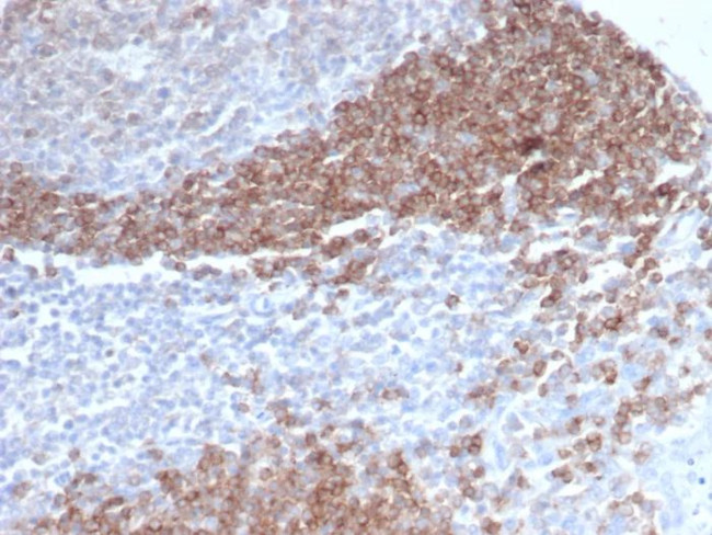 CD79b (B-Cell Marker) Antibody in Immunohistochemistry (Paraffin) (IHC (P))