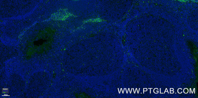 TNFRSF9/CD137 Antibody in Immunohistochemistry (PFA fixed) (IHC (PFA))