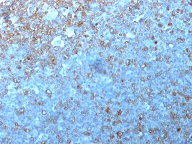 Cdk1/p34cdc2 Antibody in Immunohistochemistry (Paraffin) (IHC (P))