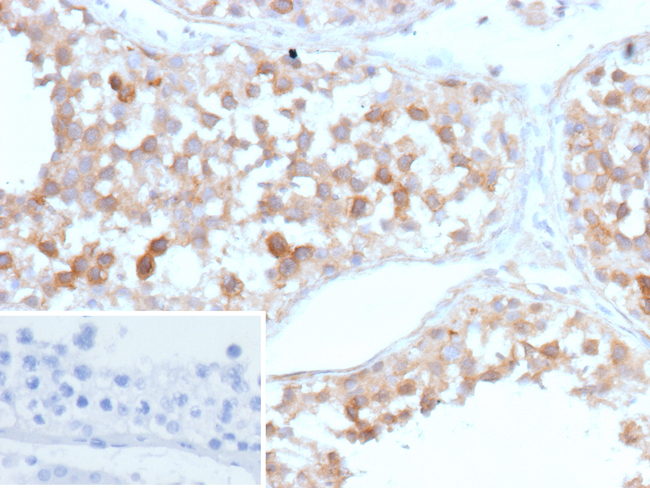 Synaptic Vesicle Protein 2 (SV2) (Marker of Neuroendocrine Cells) Antibody in Immunohistochemistry (Paraffin) (IHC (P))