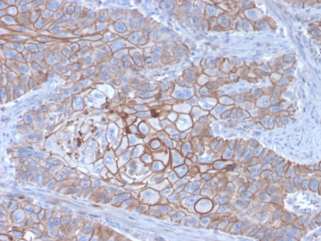 E-Cadherin (CDH1)/CD324 (Intercellular Junction Marker) Antibody in Immunohistochemistry (Paraffin) (IHC (P))