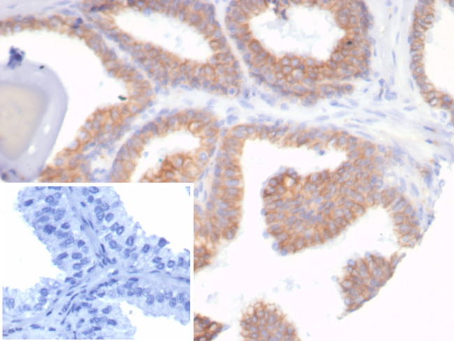 E-Cadherin (CDH1)/CD324 (Intercellular Junction Marker) Antibody in Immunohistochemistry (Paraffin) (IHC (P))