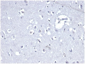 E-Cadherin (CDH1)/CD324 Antibody in Immunohistochemistry (Paraffin) (IHC (P))