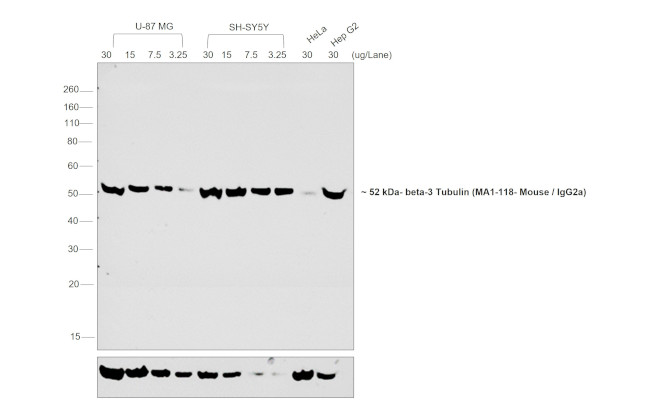 Mouse IgG2a Secondary Antibody in Western Blot (WB)