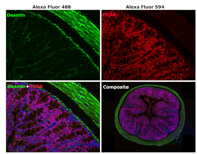 Rabbit IgG (H+L) Cross-Adsorbed Secondary Antibody in Immunohistochemistry (Paraffin) (IHC (P))