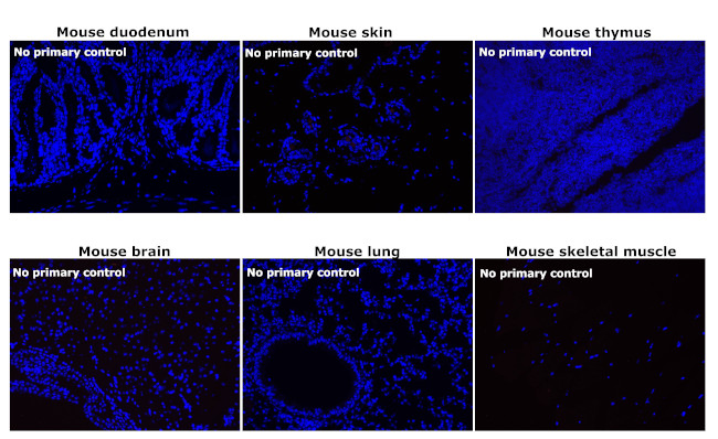 Rabbit IgG (H+L) Secondary Antibody in Immunohistochemistry (Paraffin) (IHC (P))