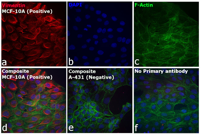 Rabbit IgG (H+L) Cross-Adsorbed Secondary Antibody in Immunocytochemistry (ICC/IF)