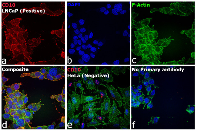 Mouse IgG2b Cross-Adsorbed Secondary Antibody in Immunocytochemistry (ICC/IF)
