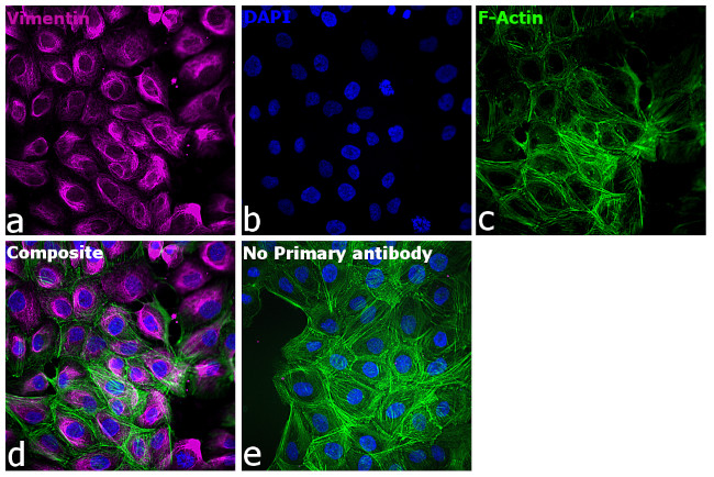 Mouse IgG1 Cross-Adsorbed Secondary Antibody in Immunocytochemistry (ICC/IF)