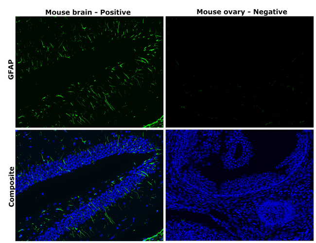 GFAP Antibody in Immunohistochemistry (Paraffin) (IHC (P))