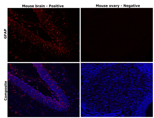 GFAP Antibody in Immunohistochemistry (Paraffin) (IHC (P))