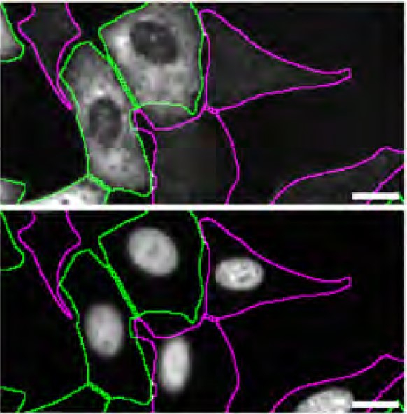Rabbit IgG (H+L) Highly Cross-Adsorbed Secondary Antibody in Immunocytochemistry (ICC/IF)