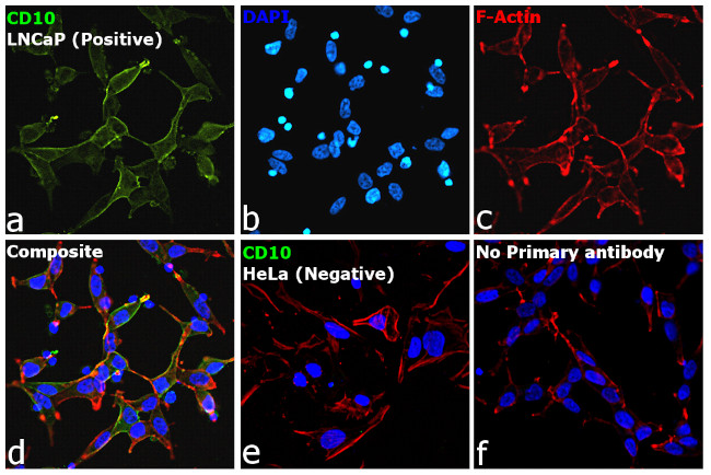 Goat IgG (H+L) Cross-Adsorbed Secondary Antibody in Immunocytochemistry (ICC/IF)