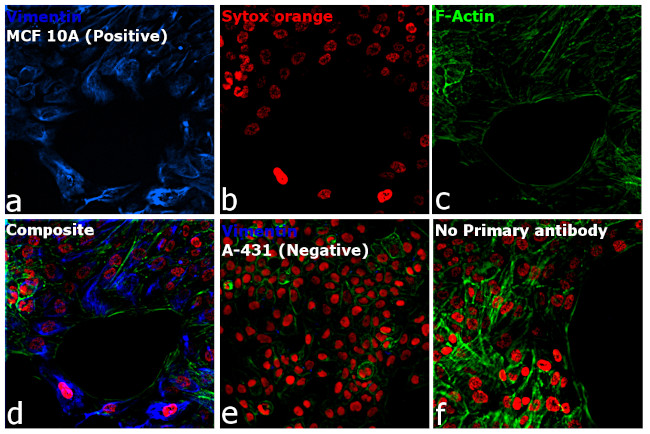 Rabbit IgG (H+L) Cross-Adsorbed Secondary Antibody in Immunocytochemistry (ICC/IF)