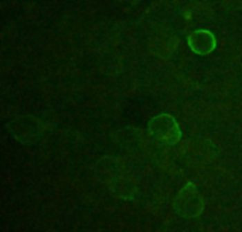 DYKDDDDK-tag Antibody in Immunocytochemistry (ICC/IF)