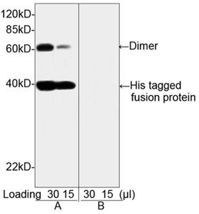 His Tag Antibody in Western Blot (WB)