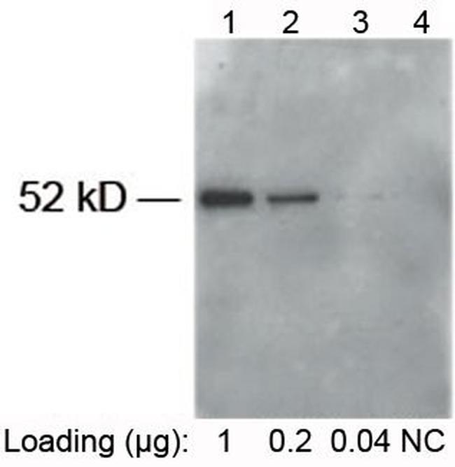 E-tag Antibody in Western Blot (WB)