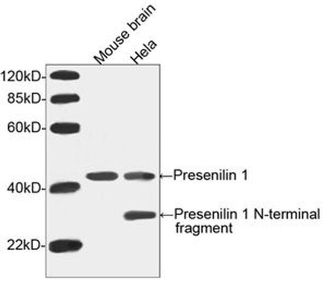 Presenilin 1 Antibody in Western Blot (WB)