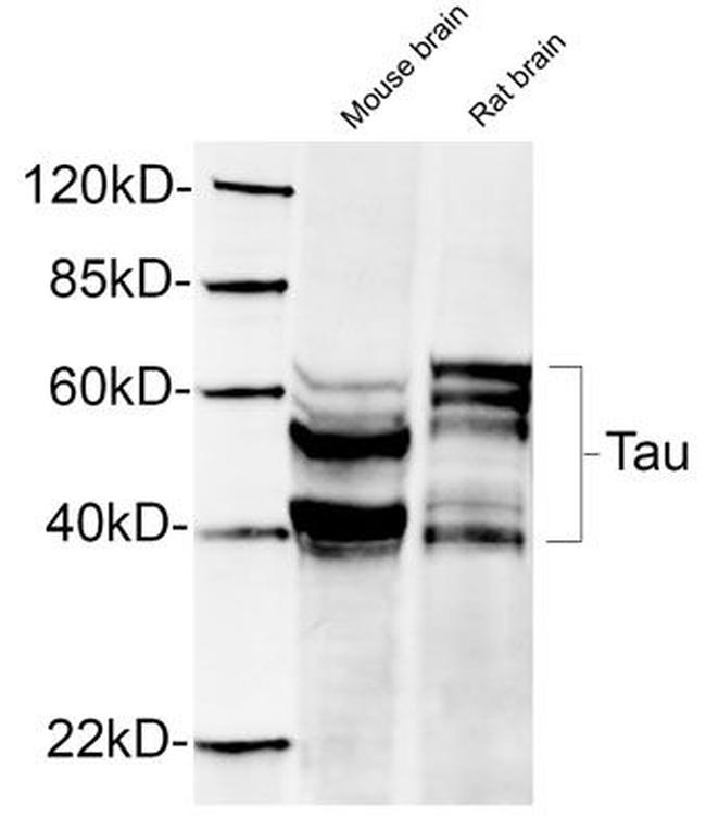 Phospho-Tau (Ser396) Antibody in Western Blot (WB)