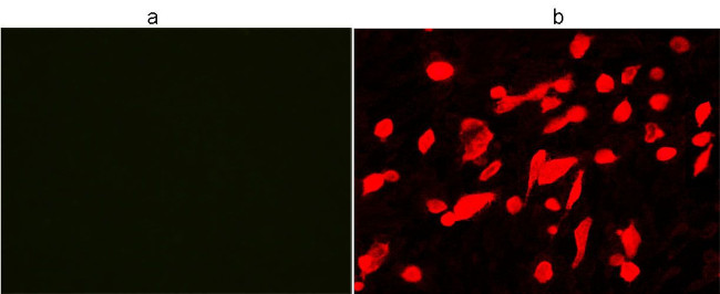 His Tag Antibody in Immunocytochemistry (ICC/IF)