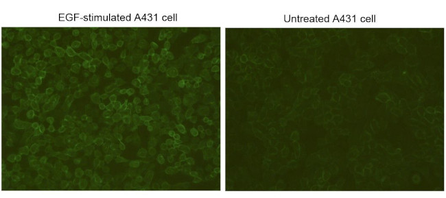 Phosphotyrosine Antibody in Immunocytochemistry (ICC/IF)