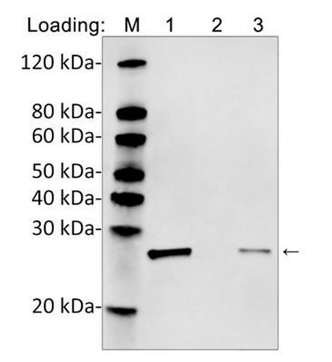 His Tag (C-term) Antibody in Western Blot (WB)