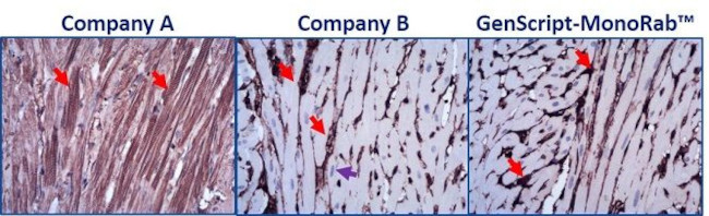 Beta Actin Antibody in Immunohistochemistry (IHC)