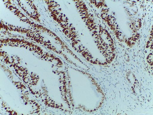 MSH6 Antibody in Immunohistochemistry (Paraffin) (IHC (P))