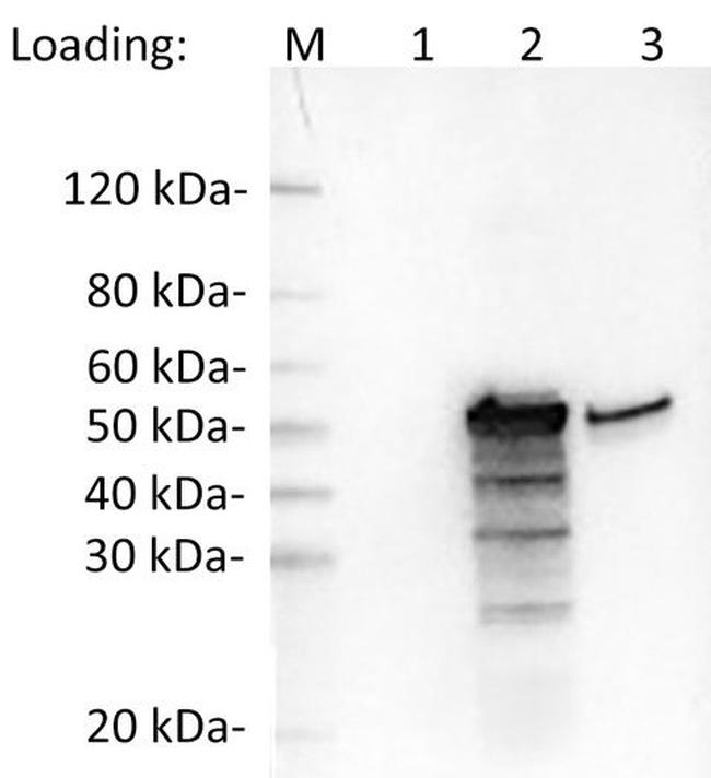 SARS-CoV-2 Nucleocapsid Antibody in Western Blot (WB)