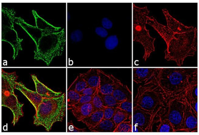 Mouse IgG1 Cross-Adsorbed Secondary Antibody in Immunocytochemistry (ICC/IF)