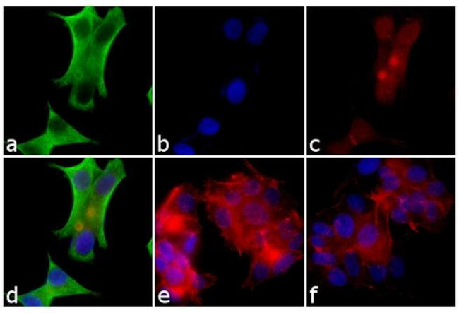 Mouse IgG, IgM, IgA (H+L) Secondary Antibody in Immunocytochemistry (ICC/IF)