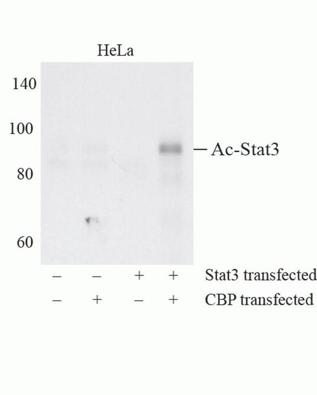 Acetyl-Stat3 (Lys685) Antibody in Western Blot (WB)