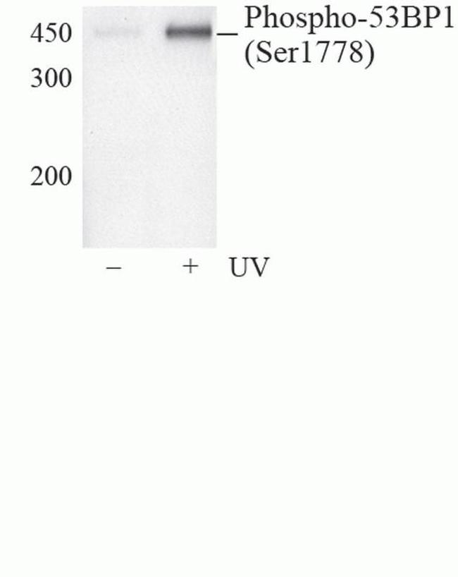 Phospho-53BP1 (Ser1778) Antibody in Western Blot (WB)