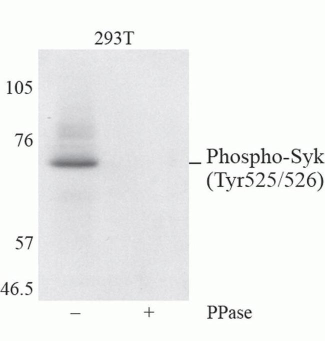 Phospho-Syk (Tyr525, Tyr526) Antibody in Western Blot (WB)