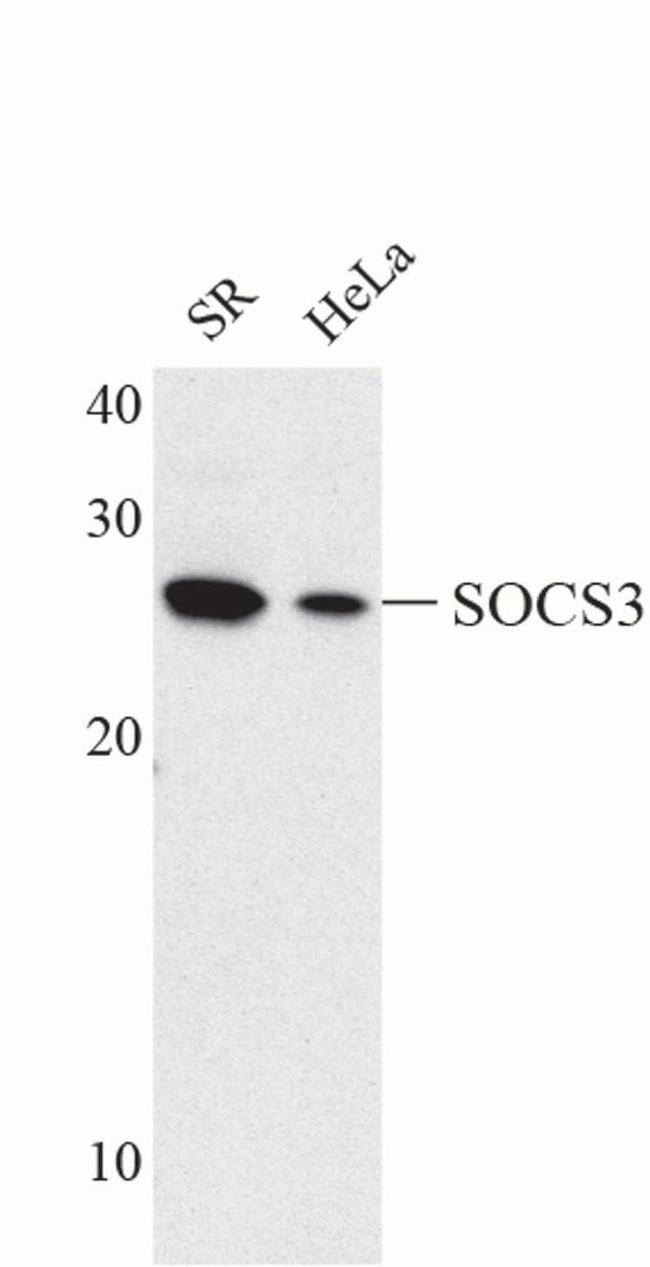 SOCS3 Antibody in Western Blot (WB)