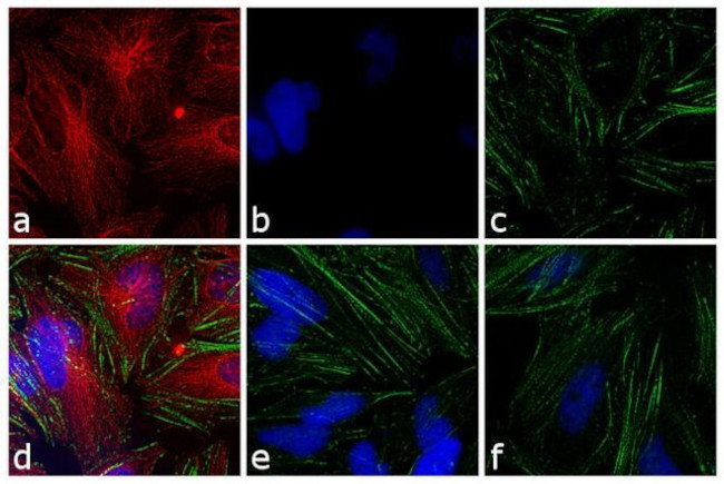 Mouse IgG (H+L) Cross-Adsorbed Secondary Antibody in Immunocytochemistry (ICC/IF)