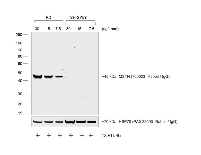 Rabbit IgG (H+L) Secondary Antibody in Western Blot (WB)