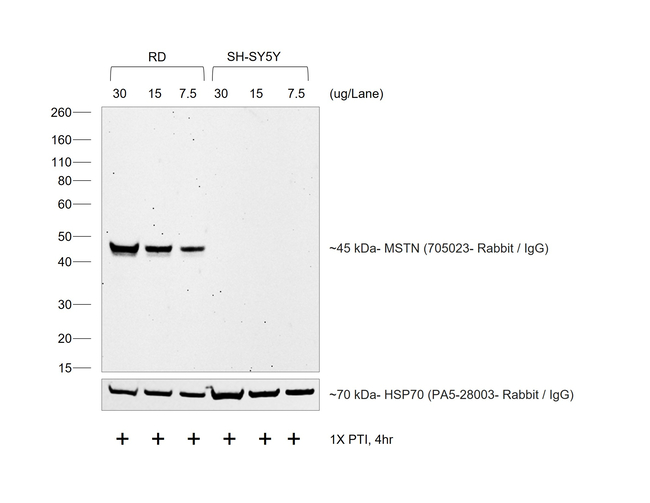 Rabbit IgG (H+L) Cross-Adsorbed Secondary Antibody in Western Blot (WB)